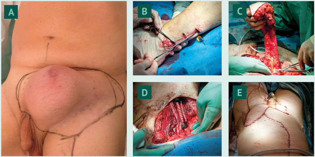 Kirurgen-2023-4-195 - Kirurgen