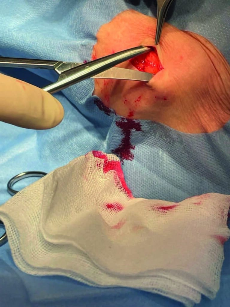 Kirurgen 3-2024_3 - Kirurgen