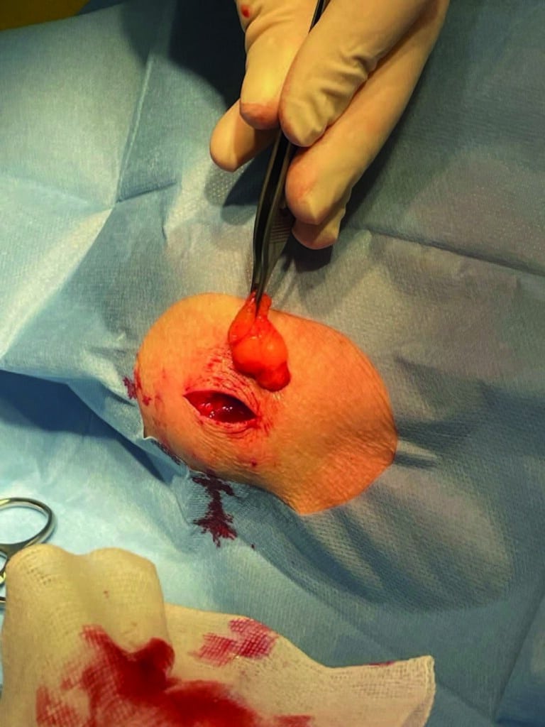 Kirurgen 3-2024_6 - Kirurgen