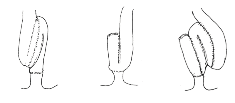 Figur 2a: S-reservoar Figur 2b: J-reservoar Figur 2c: W-reservoar Illustrasjon: Stig Norderval
