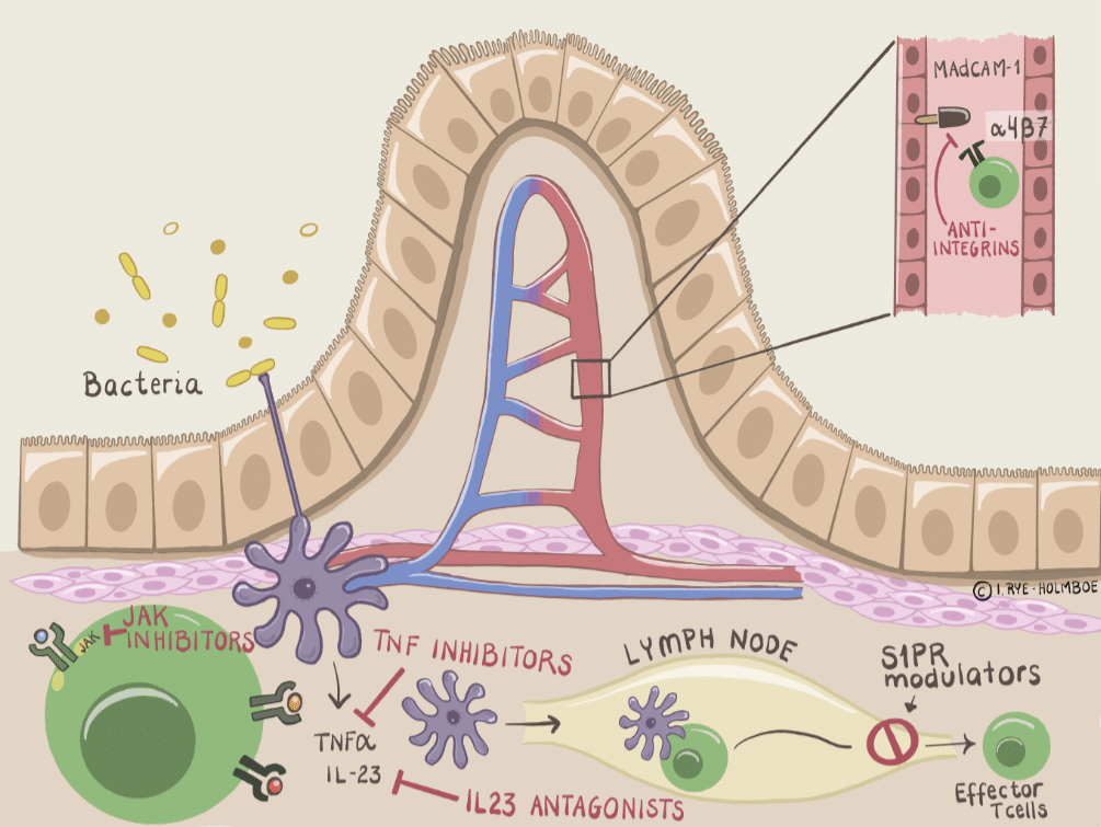 Medikamentell behandling av inflammatorisk tarmsykdom